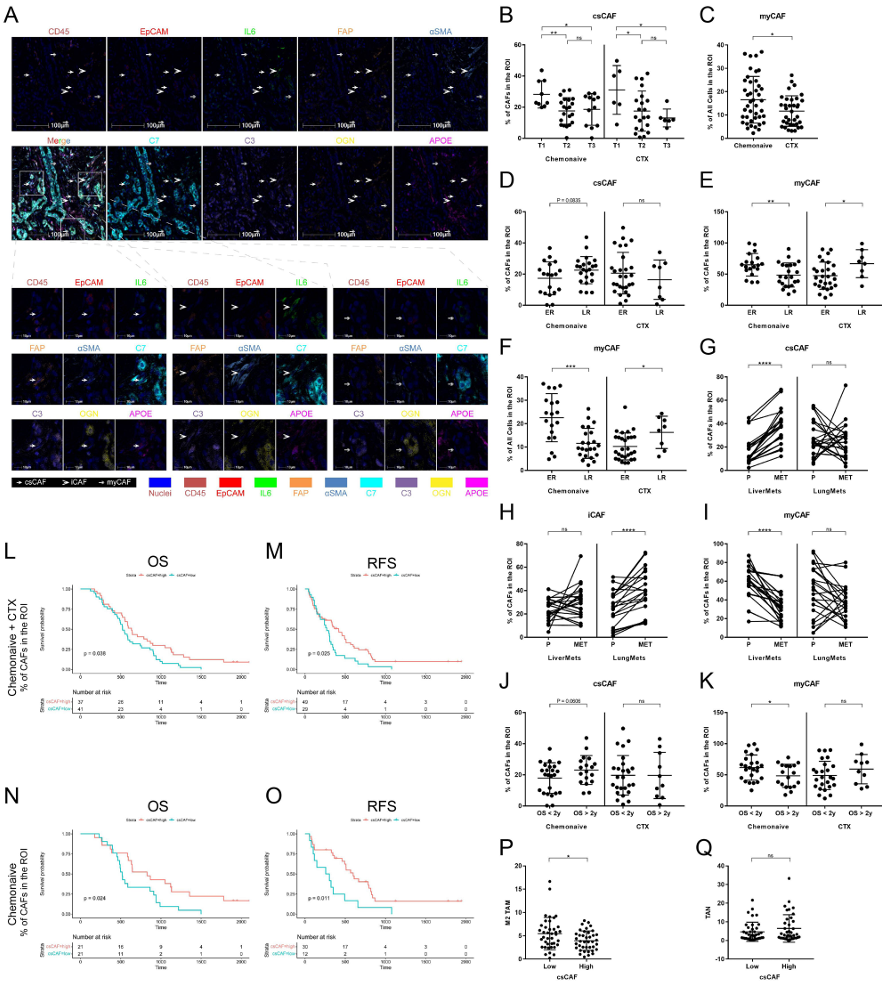 图3. csCAFs 与胰腺导管腺癌（PDAC）患者较好的临床预后相关